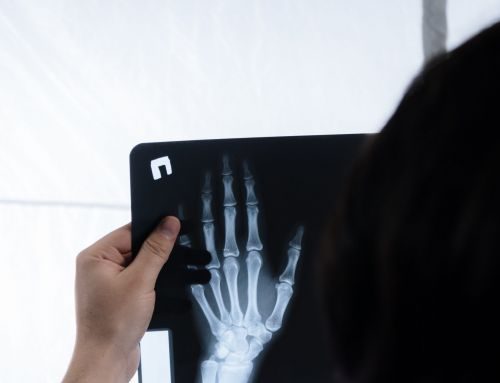 A person holding an x-ray of their hand.